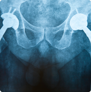 The Bone & Joint Center