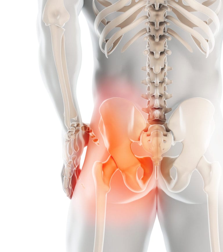 Hip Impingement