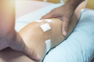 Patient on hospital bed after ACL knee surgery