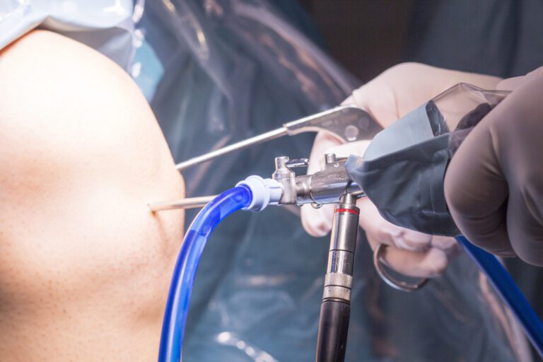 knee arthroscopy micro surgery in hospital operating theater emergency room