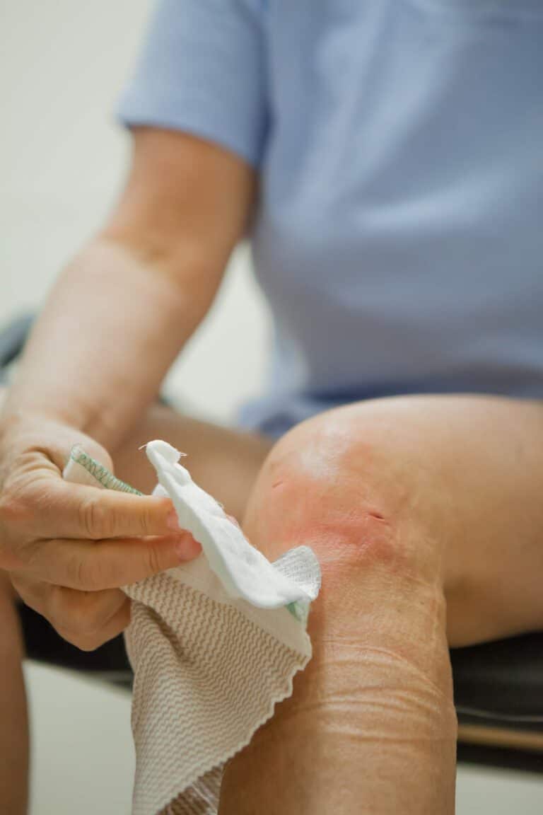 Medical: Bandaged removal arthroscopic knee surgery