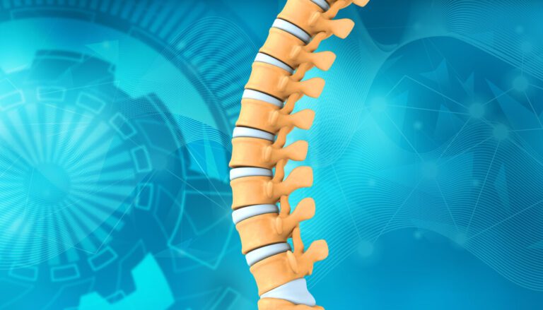 A 3D animated illustration of the human spine highlighting signs of spinal stenosis.