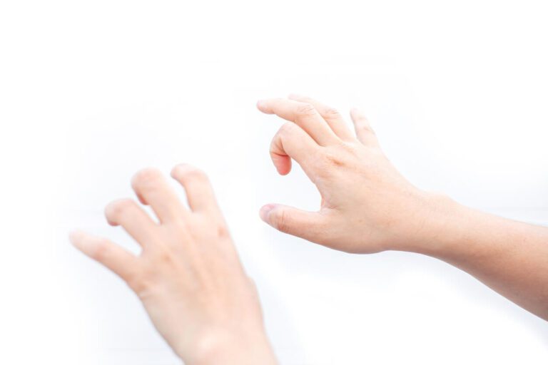 Trigger Finger Caused by People working on computer screens have been using smartphones for a long time.