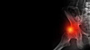 hip pain