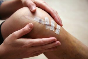 patient knee after ACL
