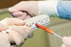 Ligament reconstruction surgery