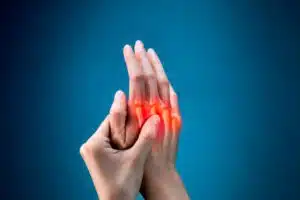Pain, Finger, Human Hand, Joint - Body Part, Medical X-ray