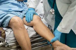 old lady woman patient show her scars surgical total knee joint replacement