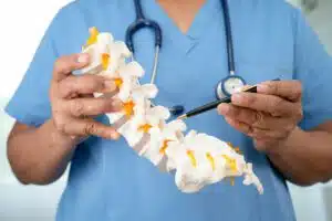 An orthopedic doctor holds a model of spinal nerves and bones to explain Degenerative Disc Disease.