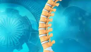 A 3D animated illustration of the human spine highlighting signs of spinal stenosis.